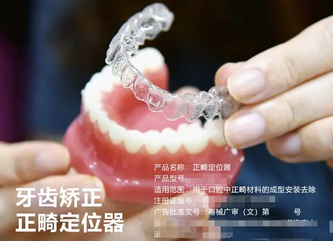 隐形牙套属于几类医疗器械?